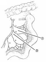 C-04